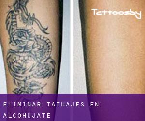 Eliminar tatuajes en Alcohujate